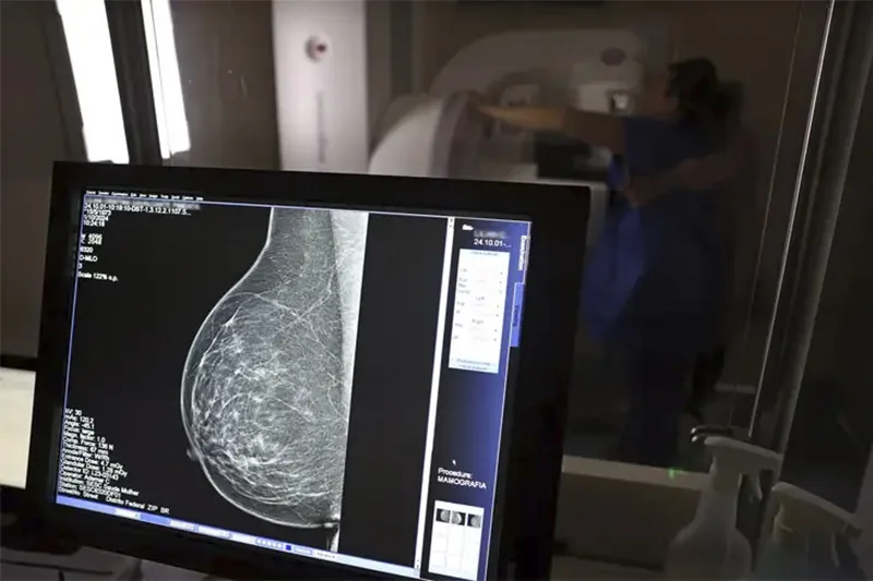 Trodelvy ganha duas novas opções de uso contra câncer de mama triplo-negativo